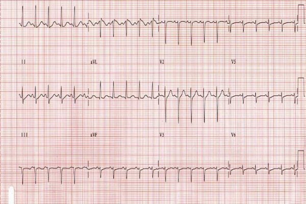 Kra48at